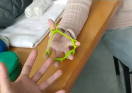 有一种痛叫妈妈手温州医生教你科学防治,守护女性双手