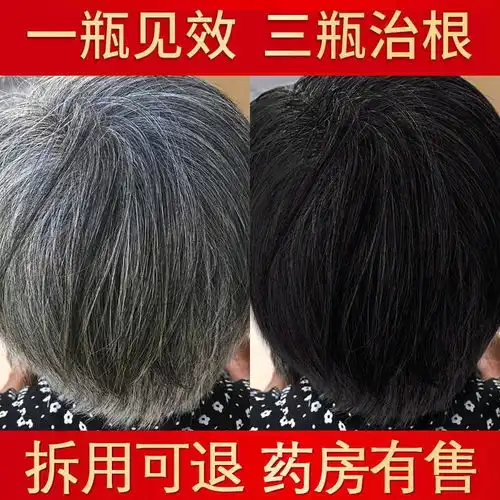 白发变黑发何首乌洗发水中草药黑发乌发男女老年少年产后白发防脱