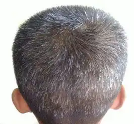 为什么到了人四十左右,有的人长的白发多,有的人却几乎没有长白发