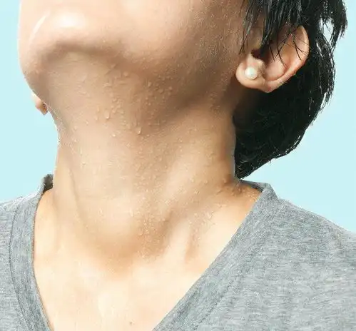 出汗是病不出汗也是病几大原因,自己了解一下