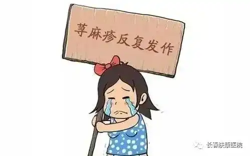 冬季荨麻疹反复发作如何是好