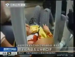 危险一根耳机线差点要了17岁姑娘的命这个坏习惯很多人都有吓尿了