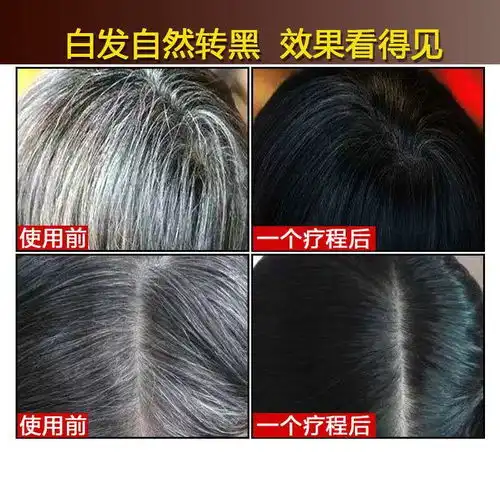 白发变黑发转黑发首乌乌发液生发洗发水液生姜止痒去屑防脱洗发露,一品好特惠