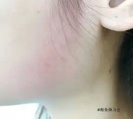 测评代购狂刷圈的抖音同款瘦脸贴,究竟是腊鸡还是3秒脸变v