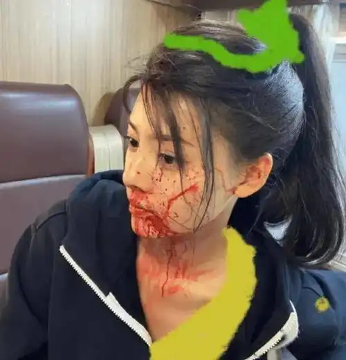 黄景瑜前妻王雨馨凌晨自杀,两人已离婚两年,迪丽热巴新剧被影响