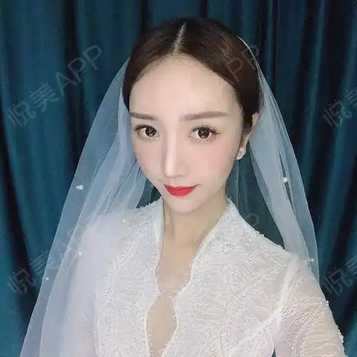 每个女孩心中,都有一个公主梦和婚纱梦,希望有一个疼...垫鼻尖悦美整形