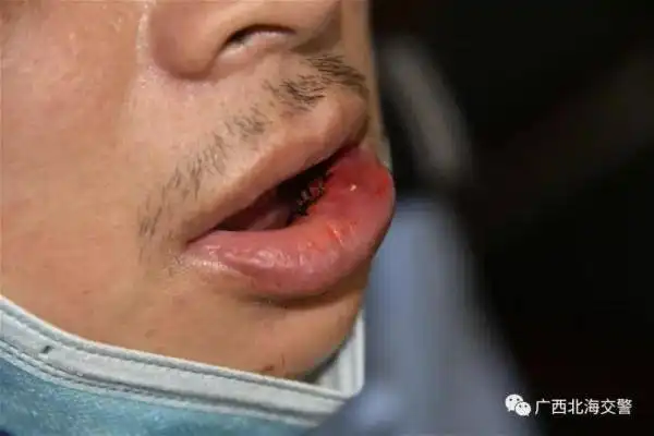 摩托车戴口罩上路,交警制止违法被拖伤,疯狂少年被刑拘