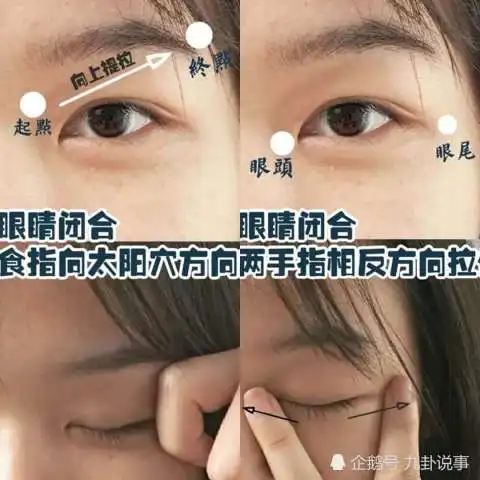 5分钟消除重度肿眼泡,告别黑眼圈,轻松get少女星星眼